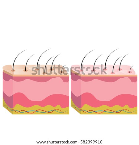 human skin stock images royalty free images vectors human skin layers stock images royalty free images vectors human skin stock images royalty free images vectors human skin layers stock images royalty free images vectors