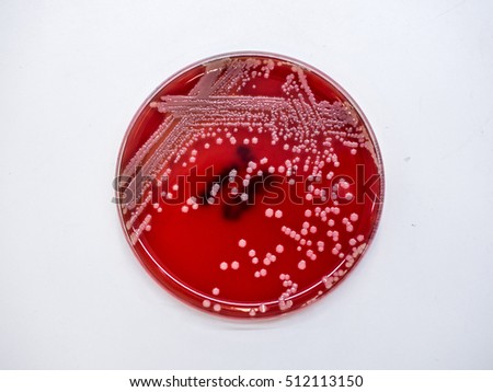 Staphylococcus Stock Images, Royalty-Free Images & Vectors | Shutterstock