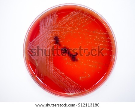 Salmonella Enteritidis Bacterial Colonies On Blood Stock Photo ...