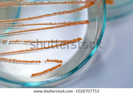 serratia marcescens lab report Serratia marcescens sarah jones loading sign in to report inappropriate content serratia - sketchymicro for usmle microbiology review . serratia marcescens lab report Serratia marcescens sarah jones loading sign in to report inappropriate content serratia - sketchymicro for usmle microbiology review .