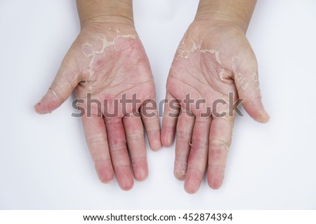 Close Wrinkled Elderly Hand Stock Photo 155976332 - Shutterstock