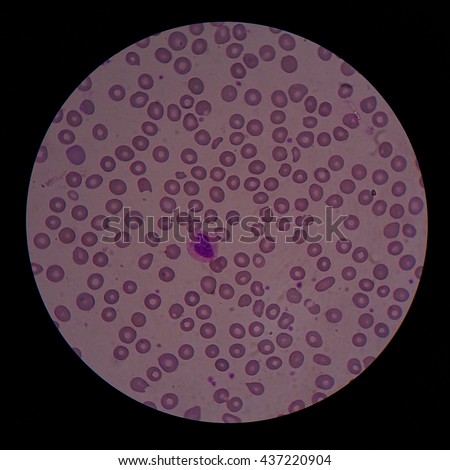 Monocyte Stock Images, Royalty-Free Images & Vectors | Shutterstock