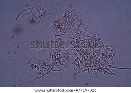 Under Microscope Showing Pseudohypha Budding Patterns Stock Photo ...