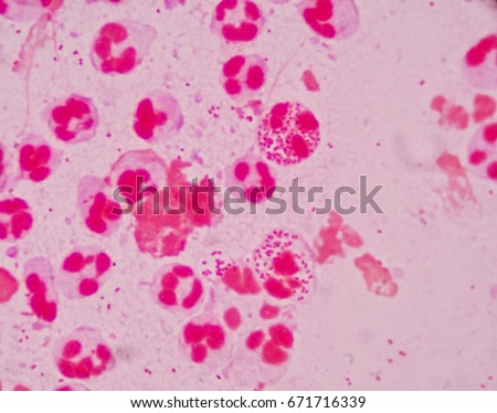 Wet Smear Gram Stain Undermicroscropy Showing Stock Photo (Edit Now ...