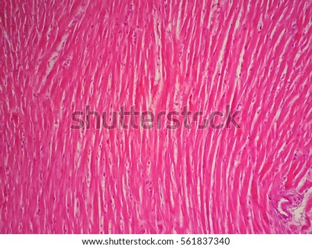 cardiac muscle stock images, royalty-free images & vectors cardiac muscle stock images, royalty-free images & vectors, Muscles