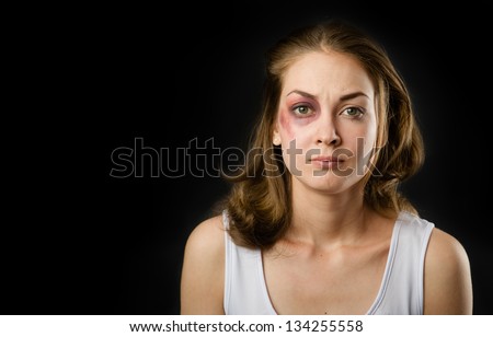 Bruised Face Stock Photos, Images, & Pictures | Shutterstock