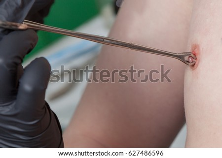 clit and nipple piercing procedures sexy yun wimen nood