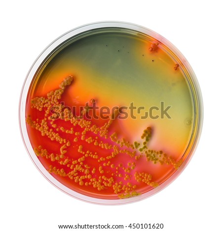 Bacillus Cereus On Petri Dish Stock Photo 222880261 - Shutterstock