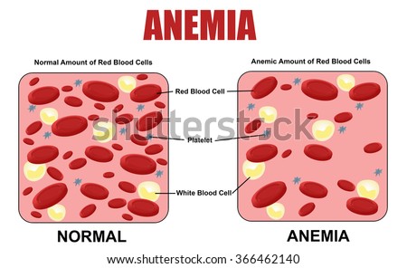 Ema cover letter table image 1