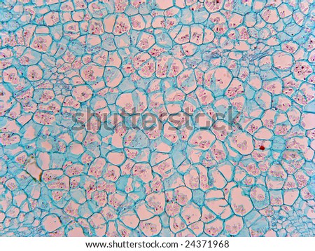 cell wall and magnification factor Cell wall matrix polysaccharide distribution and cortical microtubule organization: two factors controlling mesophyll cell morphogenesis in land. cell wall and magnification factor Cell wall matrix polysaccharide distribution and cortical microtubule organization: two factors controlling mesophyll cell morphogenesis in land.