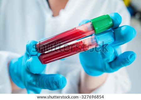 Watch Blood Work Tube Free