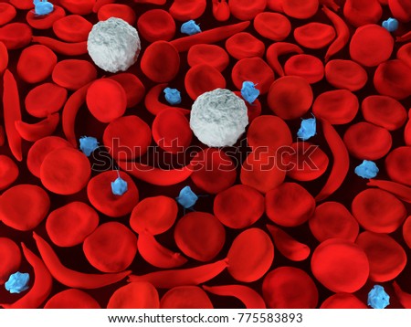 Sickle Cell Anemia Stock Images, Royalty-Free Images ...