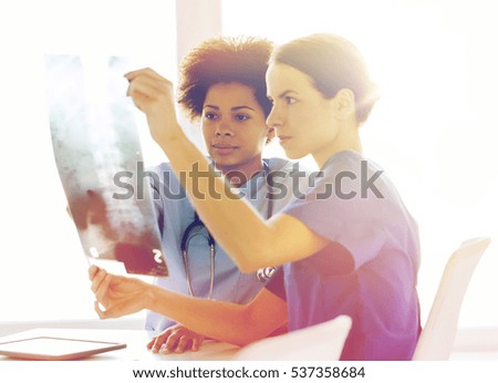 radiology, surgery, health care, people and medicine concept - female doctors or nurses looking to and discussing x-ray image of spine at hospital