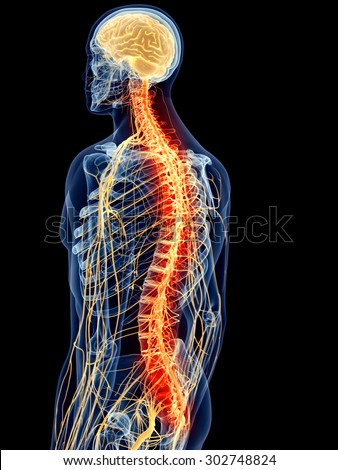 medically accurate illustration - painful spine