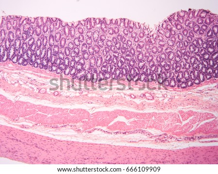 Histology Colon Human Tissue Show Epithelium Stock Photo (Royalty Free ...