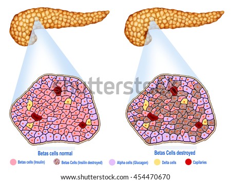 Descriptive Illustration Pancreas Pancreatic Islets Stock Illustration ...