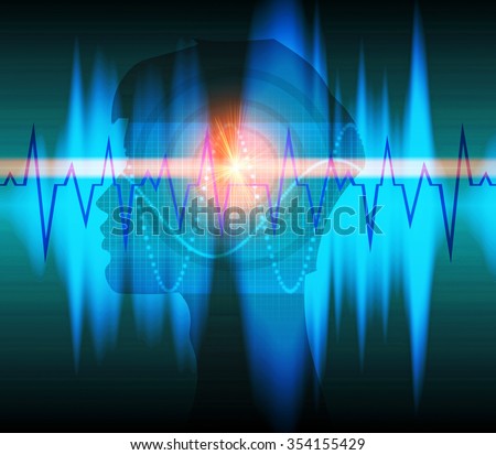 Brain activity Brain activity