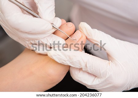 podiatrist (bác sĩ về chân) chân sạch phụ nữ