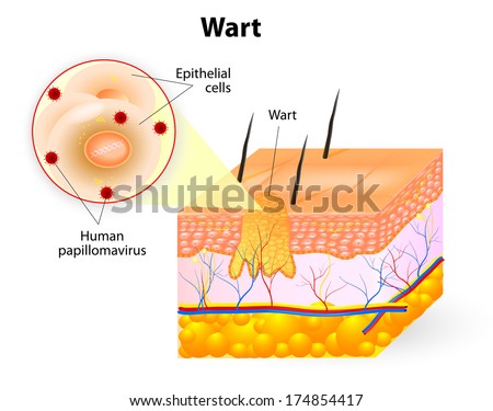 human skin layers stock images royalty free images vectors human skin layers stock images royalty free images vectors human skin layers stock images royalty free images vectors human skin layers stock images royalty free images vectors
