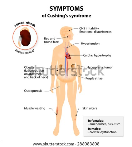 Steroids side effects constipation