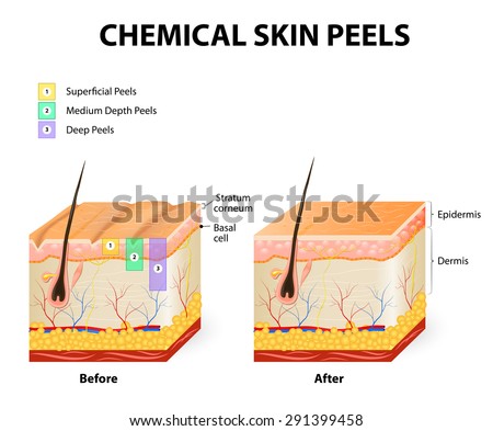 skin anatomy stock images royalty free images vectors skin anatomy stock images royalty free images vectors skin anatomy stock images royalty free images vectors skin anatomy stock images royalty free images vectors