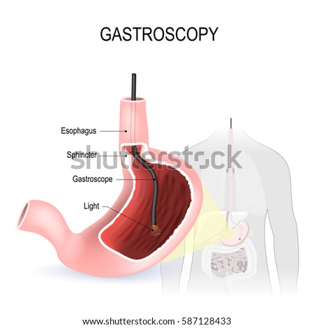 Duodenum Stock Images, Royalty-Free Images & Vectors | Shutterstock