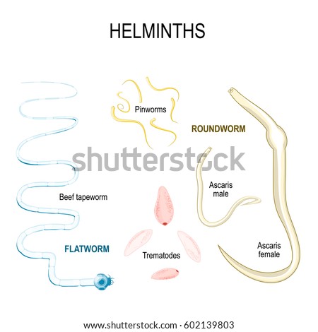 ascariasis roundworms