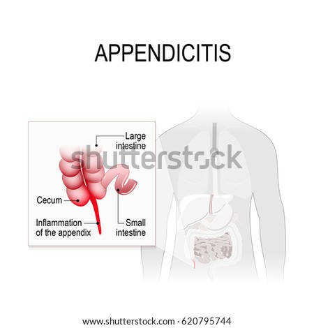 Appendix Stock Images, Royalty-Free Images & Vectors | Shutterstock