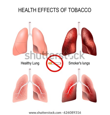 How To Get The Penis Into The Vagina Effects On Lungs From Smoking