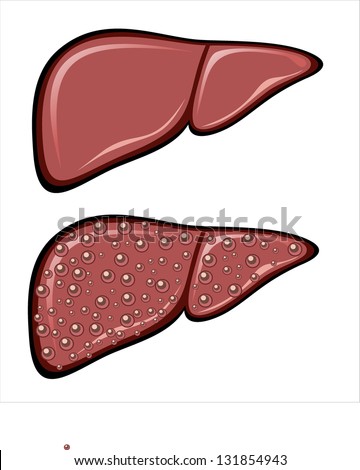Healthy Liver Stock Images, Royalty-Free Images & Vectors | Shutterstock