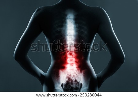 Human spine in x-ray, on gray background. The lumbar spine is highlighted by red colour.