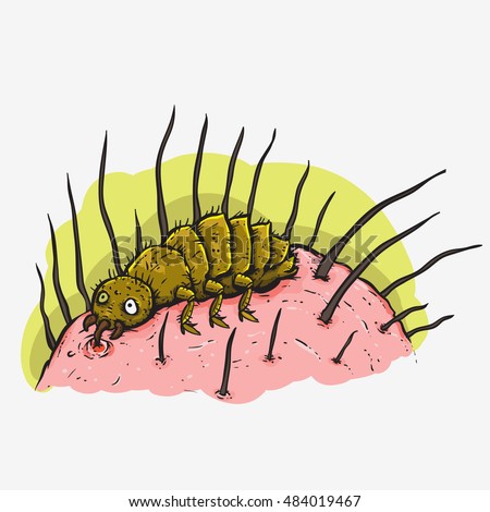 Head Lice Stock Images, Royalty-Free Images & Vectors | Shutterstock