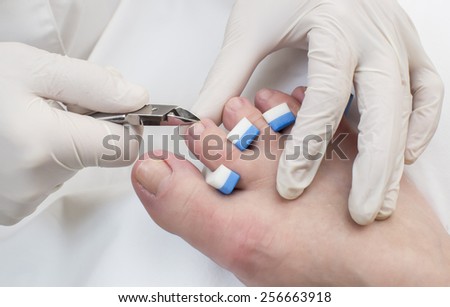 quá trình chân tại thẩm mỹ viện
