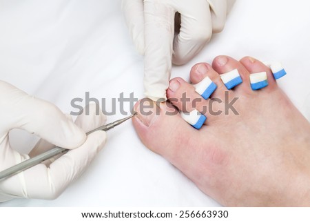 quá trình chân tại thẩm mỹ viện