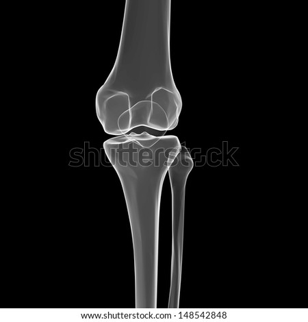 X ray of knee Stock Photos, Images, & Pictures | Shutterstock