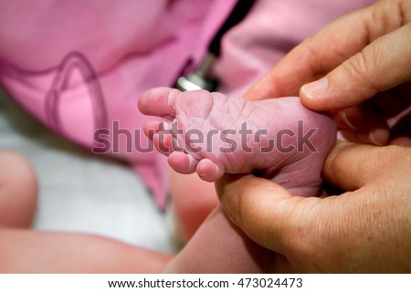 The hands of a midwife test the Babinski Reflex on the foot of a newborn.