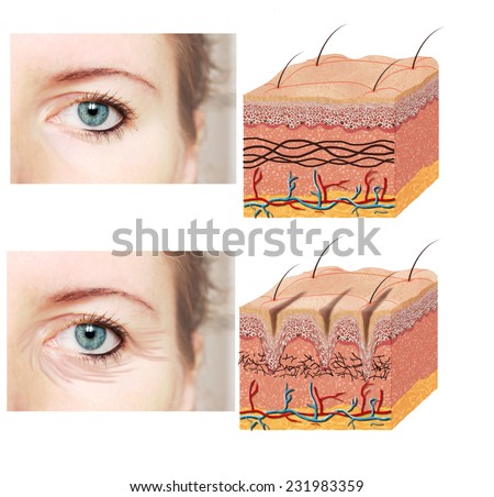 epidermis stock photo images 1 157 epidermis royalty free images and photography available to skin anatomy diagram younger skin comparation stock photo royalty free 231983359 epidermis stock photo images 1 157 epidermis royalty free images and photography available to skin anatomy diagram younger skin comparation stock photo royalty free 231983359