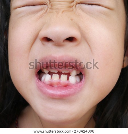Asian Girl Buck Teeth