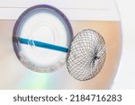 Small photo of Atrial Septal Defekt. Devices for invasive cardiology procedures. Device for atrial septal defect closure on a white background.patent foramen ovale PFO closure device.