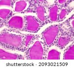 Small photo of Rabbit thyroid gland. PAS method. Due to the glycoprotein nature of thyroglobulin, the thyroid colloid is intensely PAS +. Surrounding the colloid, thyrocytes are forming a simple cuboidal epithelium