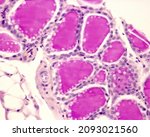 Small photo of Rabbit thyroid gland. PAS method. Due to the glycoprotein nature of thyroglobulin, the thyroid colloid is intensely PAS +. Surrounding the colloid, thyrocytes are forming a simple cuboidal epithelium.