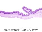Small photo of Human large intestine. The Lieberkuhn crypts of mucosa show many goblet cells stained with the PAS method. The submucosa shows a lymphoid follicle and few adipocytes. Below are the two muscular layers
