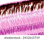 Small photo of Outer layers of the retina of a bird. From top to bottom: pigment epithelium layer with processes full of melanin granules, rod and cones layer, external limiting membrane, outer nuclear layer
