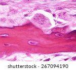 Small photo of Developing bone showing an osteoclast located in its Howships lacuna. The osteoclast is a large multinucleated cell which shows a ruffled border at a site of active bone resorption. H&E