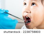 Small photo of Dental kid health examination. Doctor examines oral cavity of little child uses mouth mirror to checking teeth cavity, Asian dentist making examination procedure for smiling cute little girl