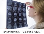 Small photo of Epileptologist examines patient MRI and electroencephalogram. Concept treating epilepsy and helping people who suffer from this disease. Neurologist at work. Pathology of the brain. Seizure activity