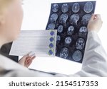 Small photo of Epileptologist examines patient MRI and electroencephalogram. Concept treating epilepsy and helping people who suffer from this disease. Neurologist at work. Pathology of the brain. Seizure activity