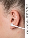 Small photo of Healing abscess Inflammation on the ear, area of suppuration. Ear furuncle. Purulent carbuncle. Treatment of abscess.