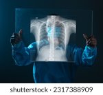 Small photo of lung radiography concept. radiology doctor examining at chest x ray film of patient at hospital room.