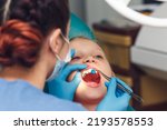 Small photo of dentist fluoridates a child's teeth. Strengthening of tooth enamel.